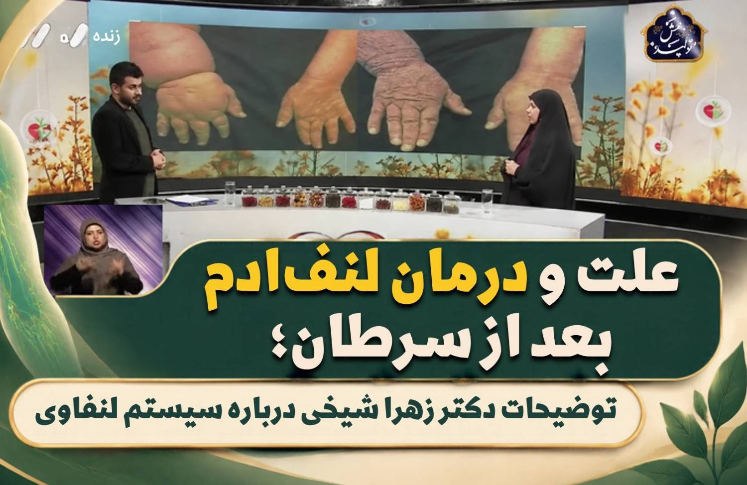 زهرا شیخی توضیح میدهد:علت و درمان لنف‌ادم بعد از سرطان، عملکرد سیستم لنفاوی
Understanding Lymphedema with Dr. Zahra Sheikhi